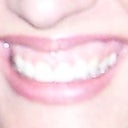 After veneers (4 front) and laser gum recontouring... still gummy