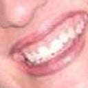 Before veneers and laser gum recontouring