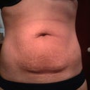 front view of baby belly (BEFORE)