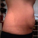 side view of baby belly (BEFORE)