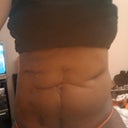 Before--multiple scarring