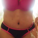 7 days post op Tummy tuck with MR. Swollen today but still much improved.Swelling is a pain in the butt.
