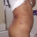 5 days after!!!!