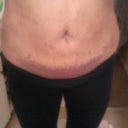 3days after!!