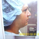 Front View Before surgery