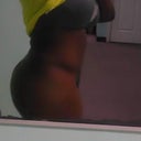 8 weeks post op!!