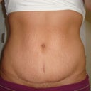 After - frontal