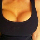 10 days post pocket tightening and saline top off (now filled to 850cc's with 700hp implants)