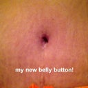 4 weeks post-op