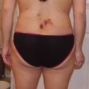 day 7 back