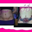 before and after photo of scar and tattoo cover up