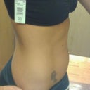 BEFORE (Also getting lipo in abdomen and flanks)
