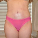 1 month PO front