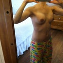 26 days post op