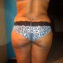 After weight gain @ 170lbs