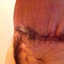 This show a big big hole of stack of skin... What sloppy sloppy job..uneffort