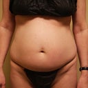 ugh.. the pot belly front