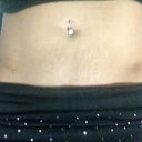 Stretch marks :/ and if you look closely you can see the incisions from the lipo right beside each hip bone.
