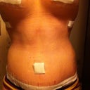 Still so swollen, my poor prego looking belly at 3 weeks I think?