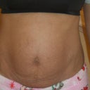 Before front