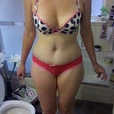 2 weeks post op