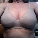 2 weeks post op