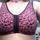 2 weeks post op