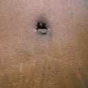 my belly button after stiches are off
