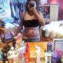10 days post op