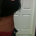 day 15 ~ side view ..still very swollen ~ binder leaves marks on my skin