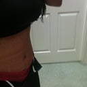 day 15 ~ side view swollen ;(