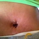 Belly button pic