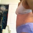11 day po side view