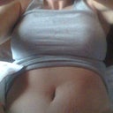 Day 2.  Way more swollen then yesterday.  :/