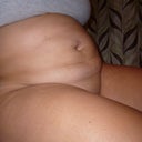 10/18/12 pre op pic 5