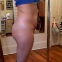 1 month pre-op gained weight from June 2012 pics