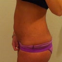 Preop picture 2
