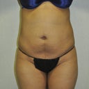 After still swollen
