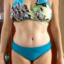 2 months PO - I'd say this is a radical change from my "before", thanks Dr. G!