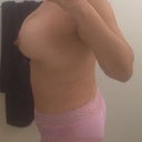 9 weeks right side