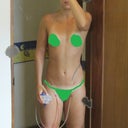 1 week+5 days post surgery.