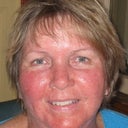 This was the day after my 2nd treatment. Obviously very swollen.