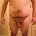 before surgery
