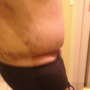 2 weeks Post op