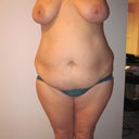 2 months before, full frontal shot
