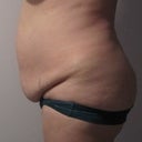 2 months before, left side
