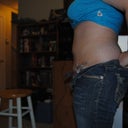 10 days after surgery