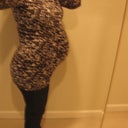 2 days before giving birth.  About 13 months after procedure. About 50 pounds heavier.