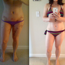 about 2 weeks post op. the other is 14 months postpartum.  probably 10 lbs heavier.