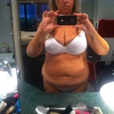 Before surgery!